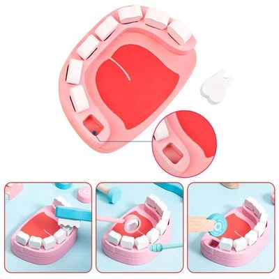 Enbaoxin Holzsimulation Arzt Spielzeugset Kinderkrankenschwester-Stoff-Arzt-Spielzeug 4 Enbaoxin Holzsimulation Arzt Spielzeugset Kinderkrankenschwester-Stoff-Arzt-Spielzeug – Bild 2